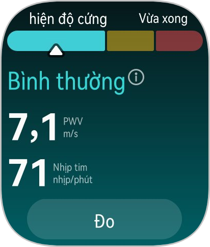 Tôi dùng đồng hồ mới lần đầu tiên ra mắt của Huawei: Quá thực dụng!- Ảnh 20.