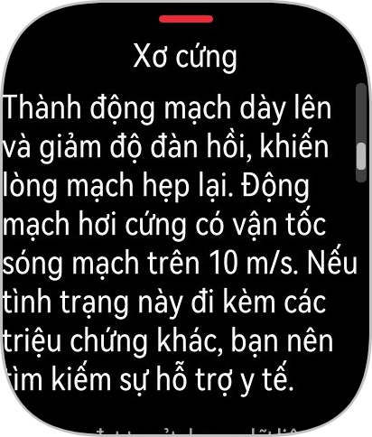 Tôi dùng đồng hồ mới lần đầu tiên ra mắt của Huawei: Quá thực dụng!- Ảnh 22.
