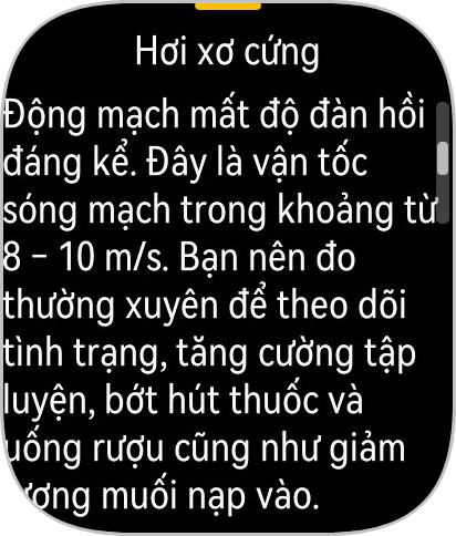 Tôi dùng đồng hồ mới lần đầu tiên ra mắt của Huawei: Quá thực dụng!- Ảnh 21.